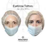 Ημιμόνιμο Τατουάζ Φρυδιών Με Την Τεχνική Σκίασης (Αθήνα By BROWS MEDICS) (8)